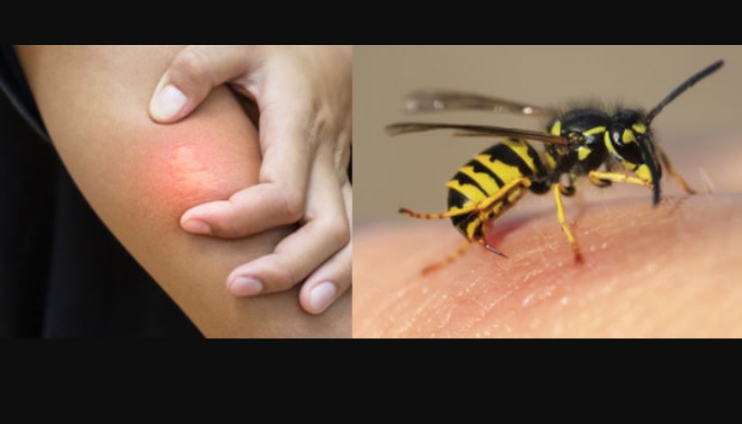 14 hospitalized in wasp attack at school